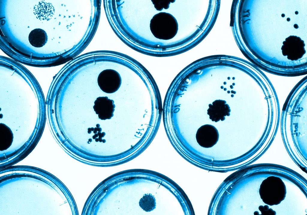 Growing Bacteria in Petri Dishes.