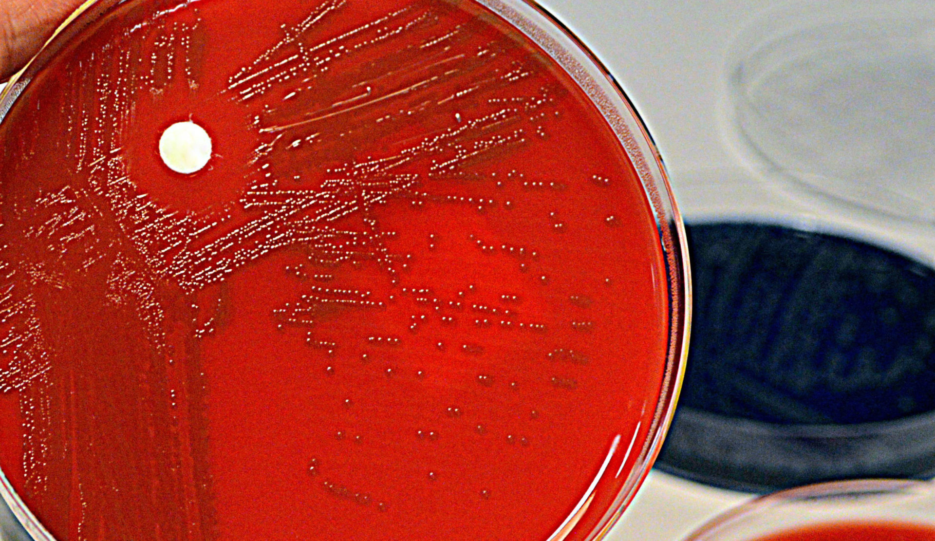 Streptococcus pneumoniae, a potentially deadly pathogen