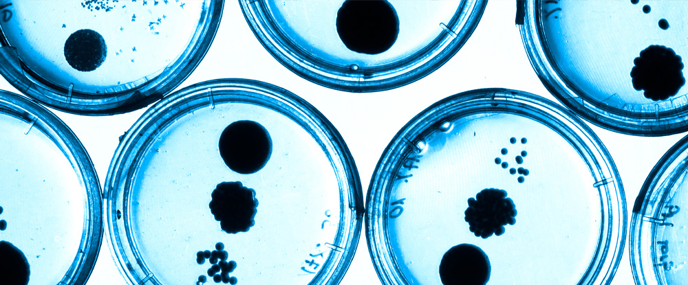 What does water have to do with antimicrobial resistance?